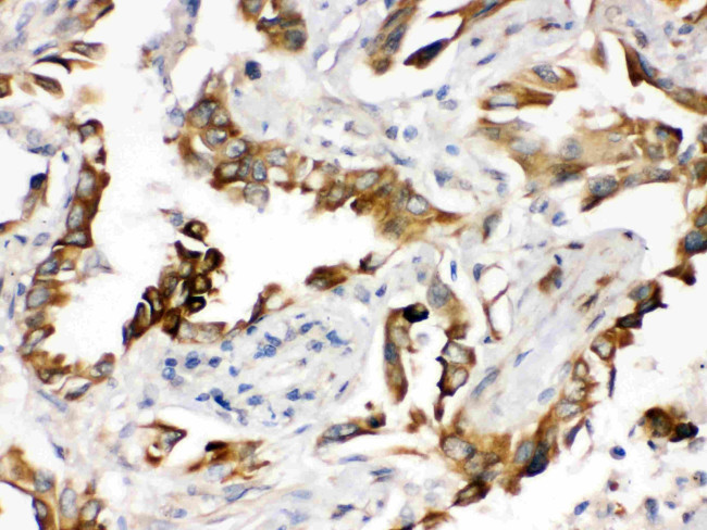 PGRMC1 Antibody in Immunohistochemistry (Paraffin) (IHC (P))