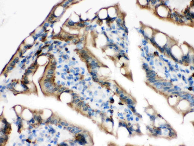 Plectin Antibody in Immunohistochemistry (Paraffin) (IHC (P))