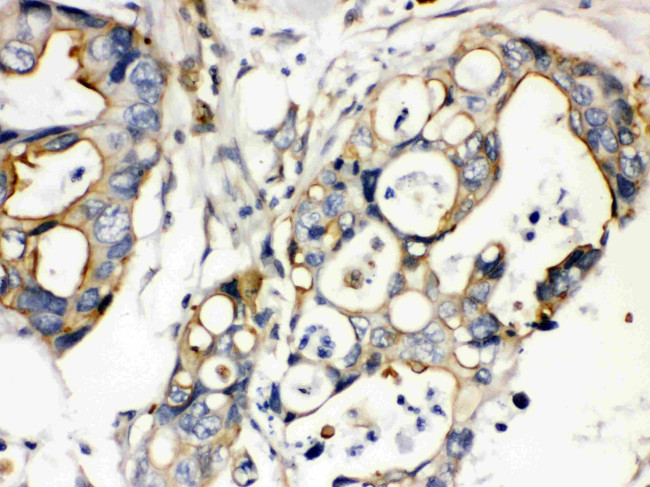 Plectin Antibody in Immunohistochemistry (Paraffin) (IHC (P))