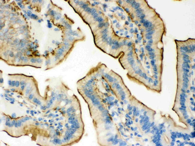 Plectin Antibody in Immunohistochemistry (Paraffin) (IHC (P))