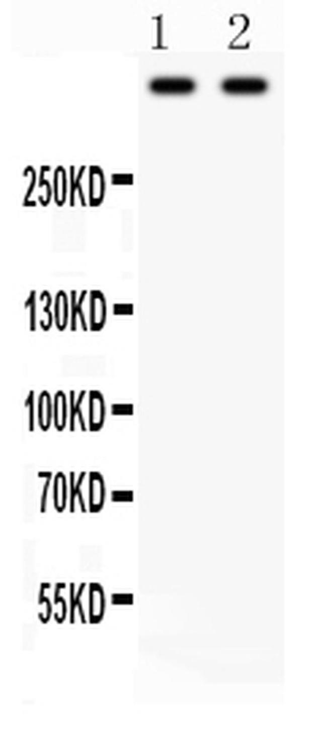 Plectin Antibody in Western Blot (WB)