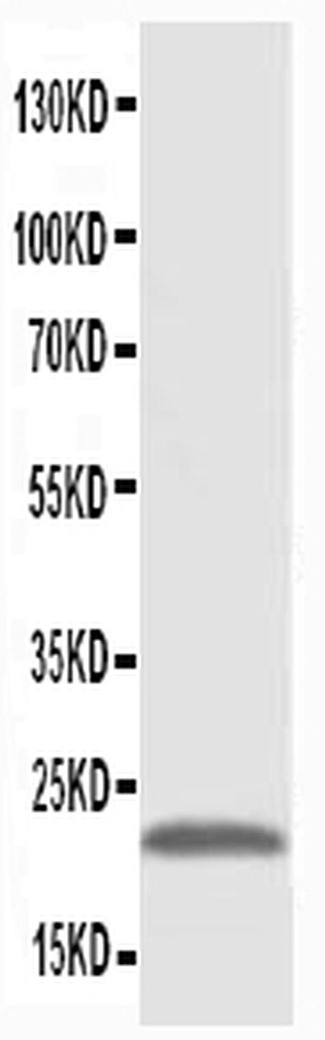 PMVK Antibody in Western Blot (WB)