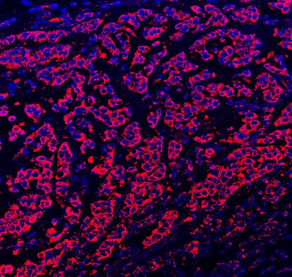 Paxillin Antibody in Immunohistochemistry (Paraffin) (IHC (P))