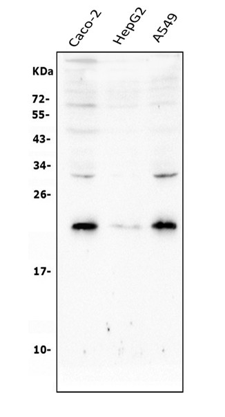 RAB8A Antibody in Western Blot (WB)