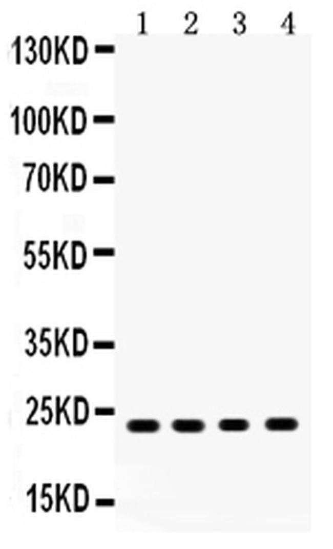 RBP4 Antibody in Western Blot (WB)