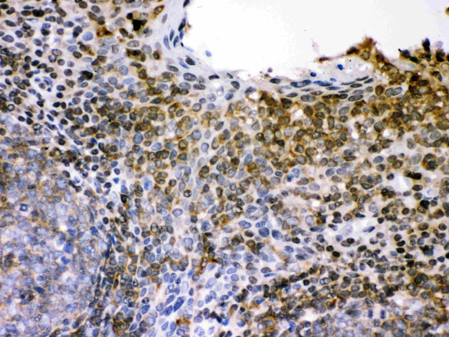 L-Selectin (CD62L) Antibody in Immunohistochemistry (Paraffin) (IHC (P))