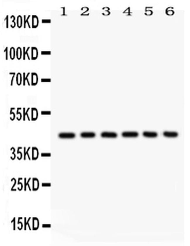 L-Selectin (CD62L) Antibody in Western Blot (WB)