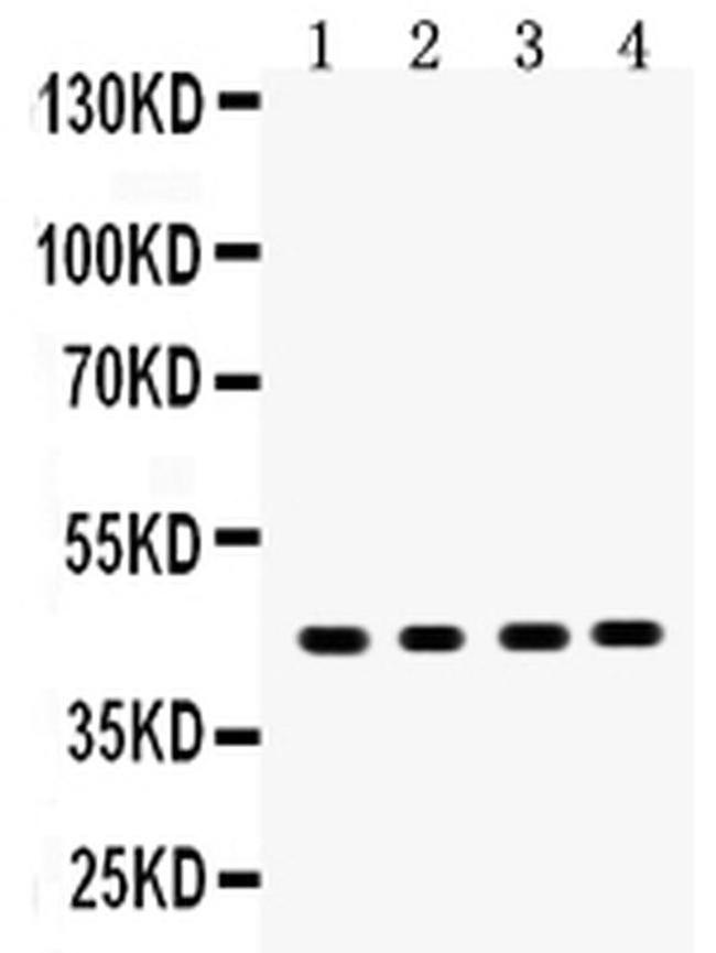 Maspin Antibody in Western Blot (WB)