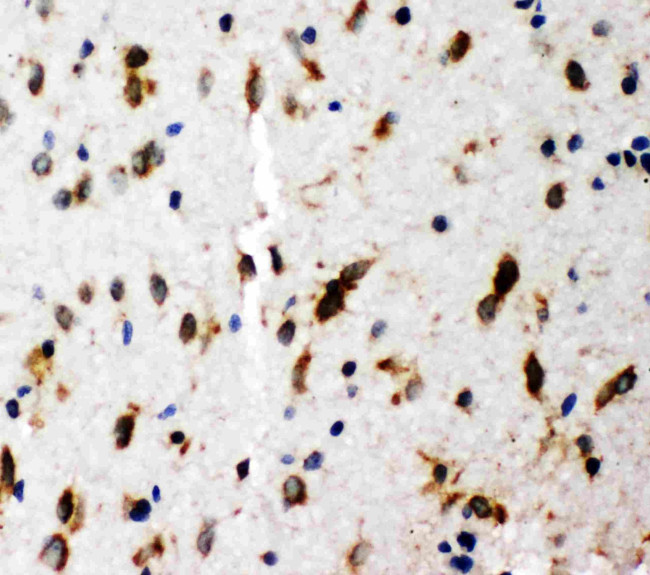 SHC Antibody in Immunohistochemistry (Paraffin) (IHC (P))