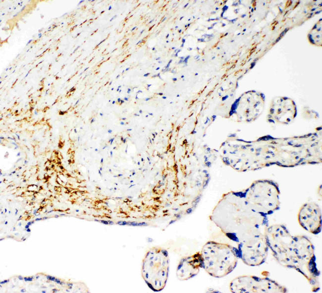 SLC16A4 Antibody in Immunohistochemistry (Paraffin) (IHC (P))