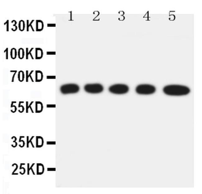 SLC22A5 Antibody in Western Blot (WB)