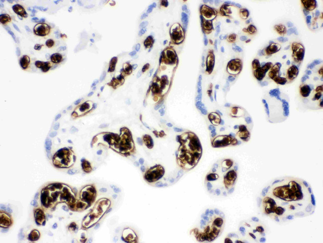 Band 3 Antibody in Immunohistochemistry (Paraffin) (IHC (P))