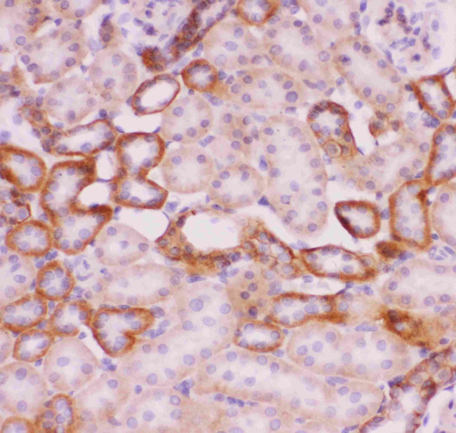 Nhe-1 Antibody in Immunohistochemistry (Paraffin) (IHC (P))