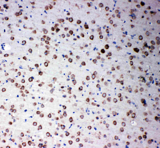 SMAD4 Antibody in Immunohistochemistry (Paraffin) (IHC (P))