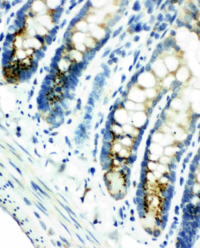 SMAD4 Antibody in Immunohistochemistry (Paraffin) (IHC (P))