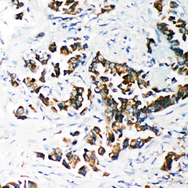 SMAD4 Antibody in Immunohistochemistry (Paraffin) (IHC (P))