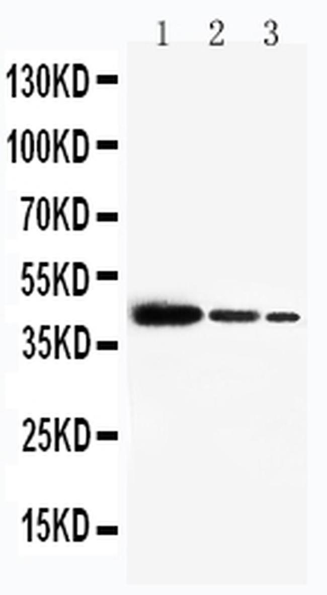 SMARCB1 Antibody in Western Blot (WB)