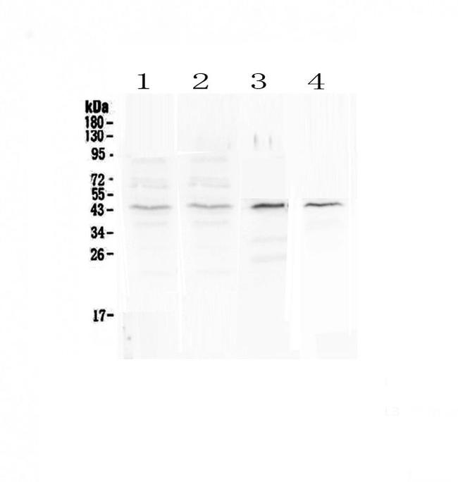 SP6 Antibody in Western Blot (WB)