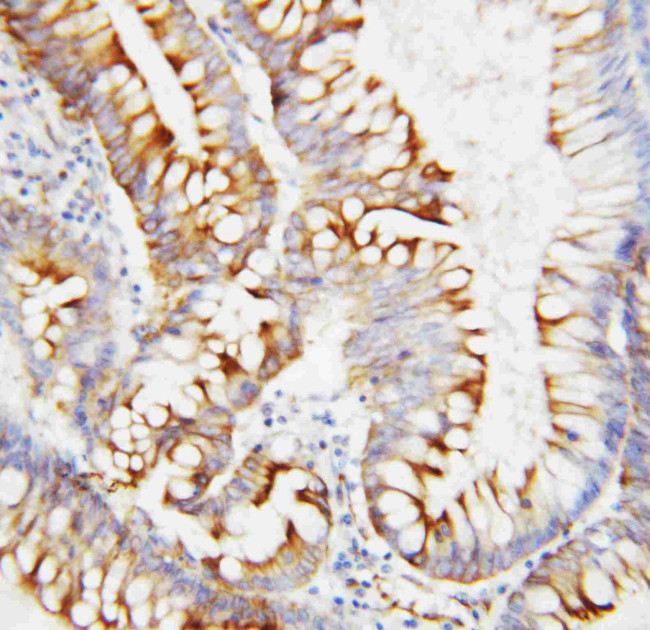 SPARC Antibody in Immunohistochemistry (Paraffin) (IHC (P))