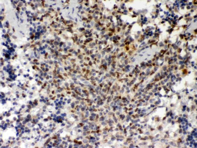 PU.1 Antibody in Immunohistochemistry (Paraffin) (IHC (P))