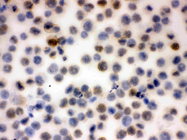 CD43 Antibody in Immunocytochemistry (ICC/IF)