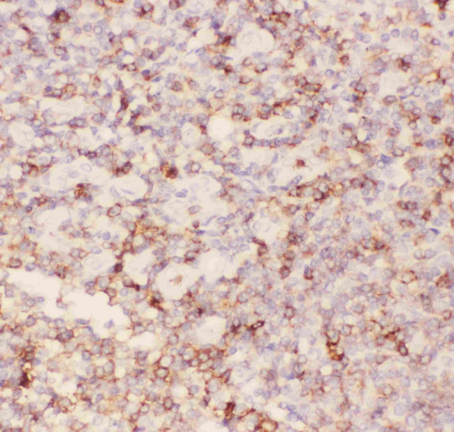 CD43 Polyclonal Antibody (PA5-80067)