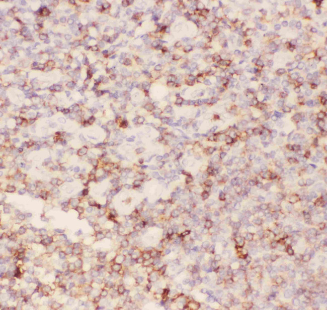 CD43 Antibody in Immunohistochemistry (Paraffin) (IHC (P))