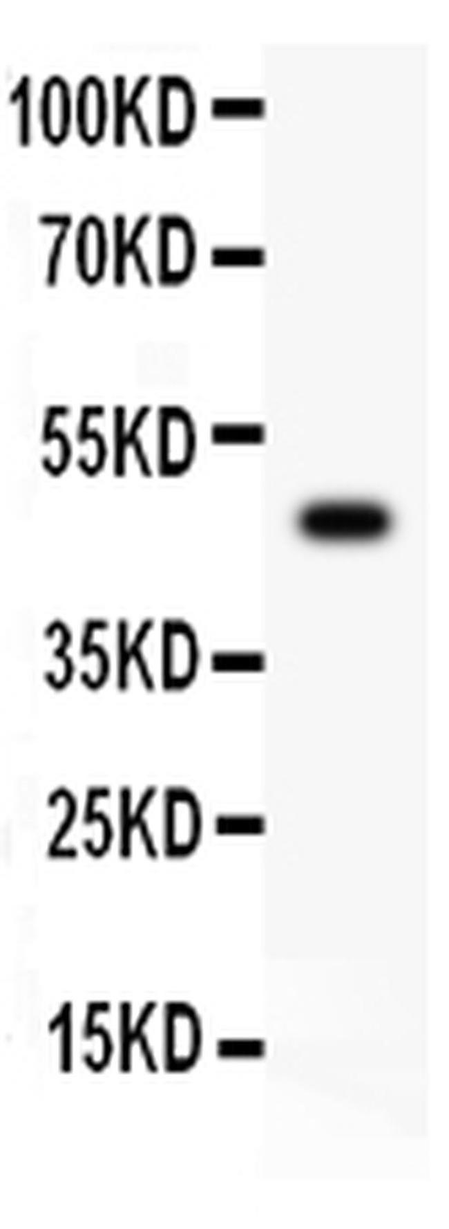 CD43 Antibody in Western Blot (WB)