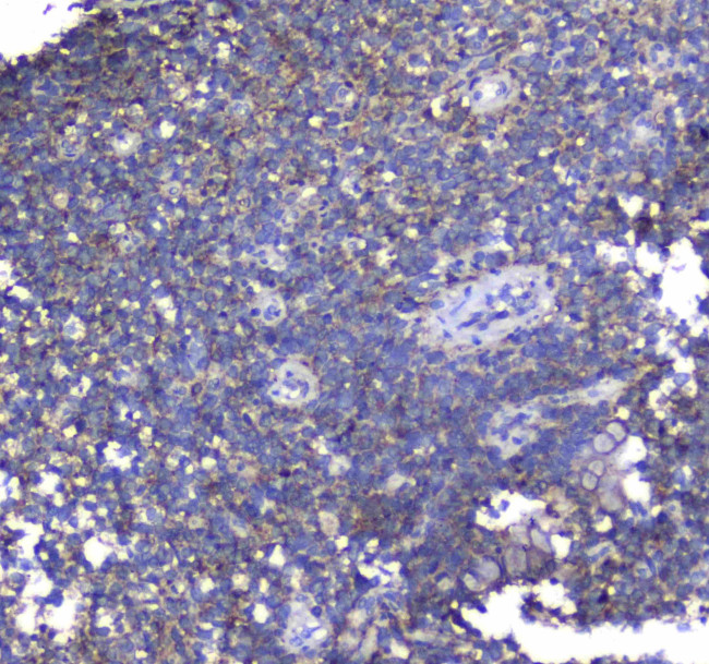 Synaptotagmin 1 Antibody in Immunohistochemistry (Paraffin) (IHC (P))