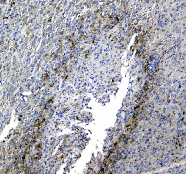 Synaptotagmin 1 Antibody in Immunohistochemistry (Paraffin) (IHC (P))