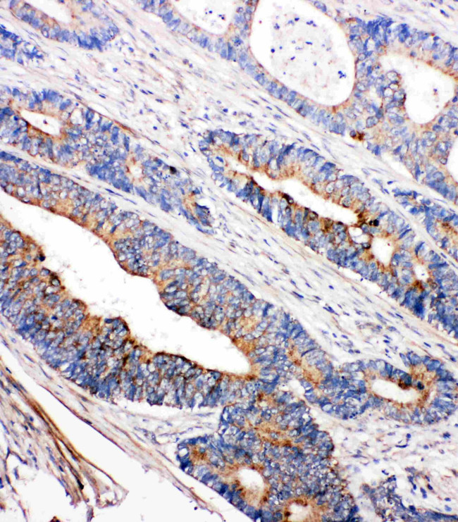 TEC Antibody in Immunohistochemistry (Paraffin) (IHC (P))