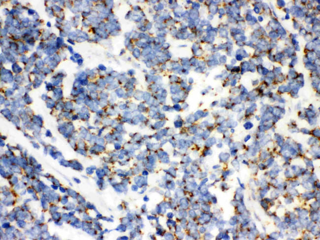 TFAM Antibody in Immunohistochemistry (Paraffin) (IHC (P))