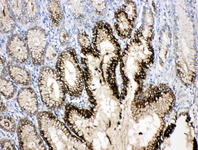 TFF1 Antibody in Immunohistochemistry (Paraffin) (IHC (P))