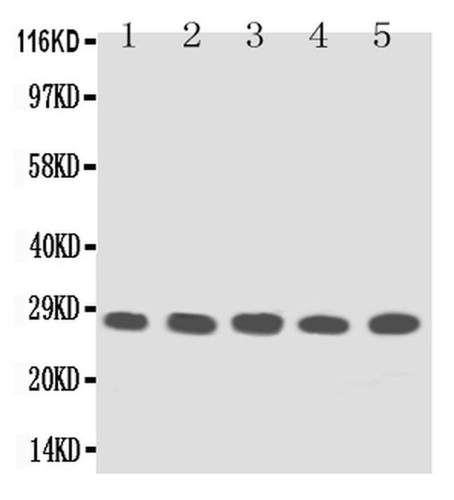 TFPI2 Antibody in Western Blot (WB)