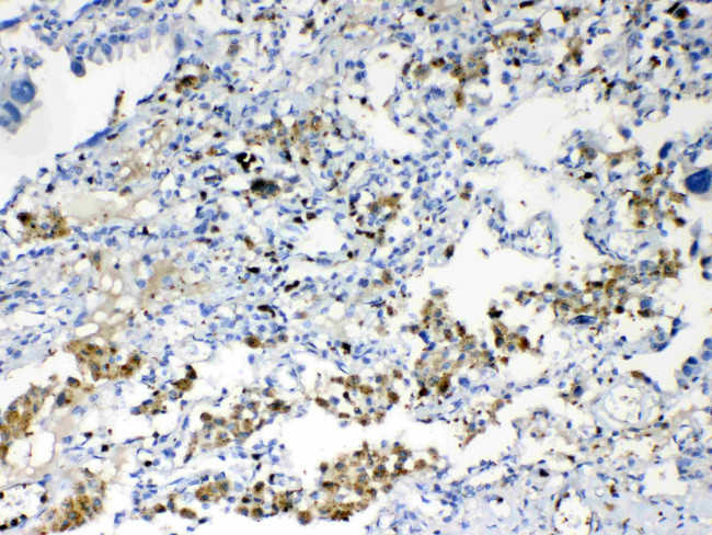 TMEM107 Antibody in Immunohistochemistry (Paraffin) (IHC (P))