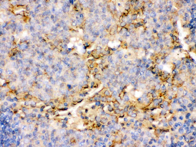 OX40 (CD134) Antibody in Immunohistochemistry (Paraffin) (IHC (P))