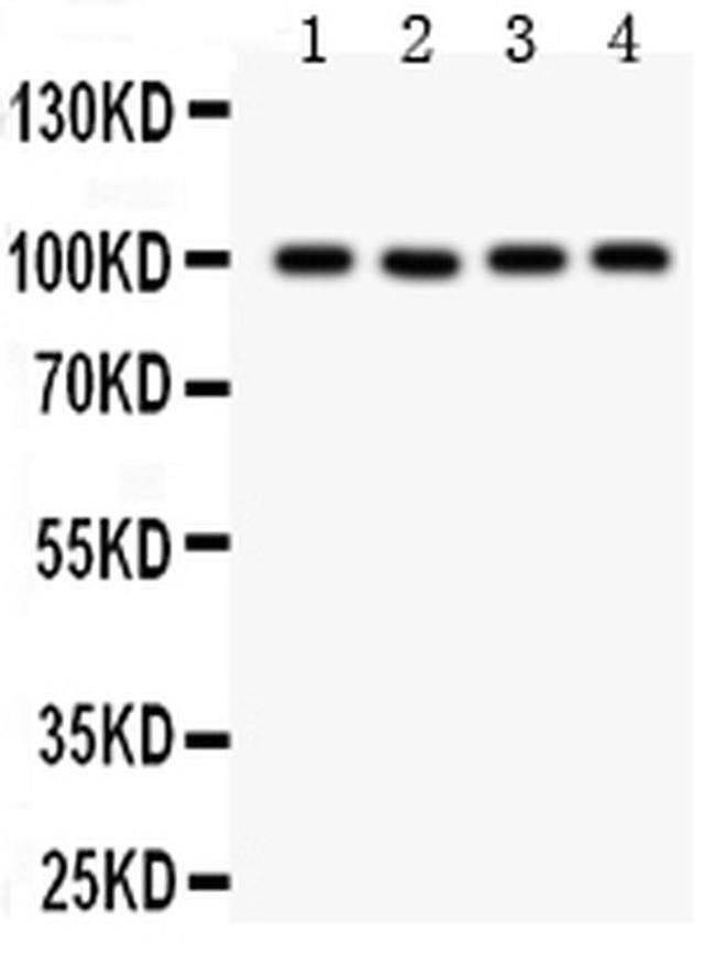 TRPC7 Antibody in Western Blot (WB)