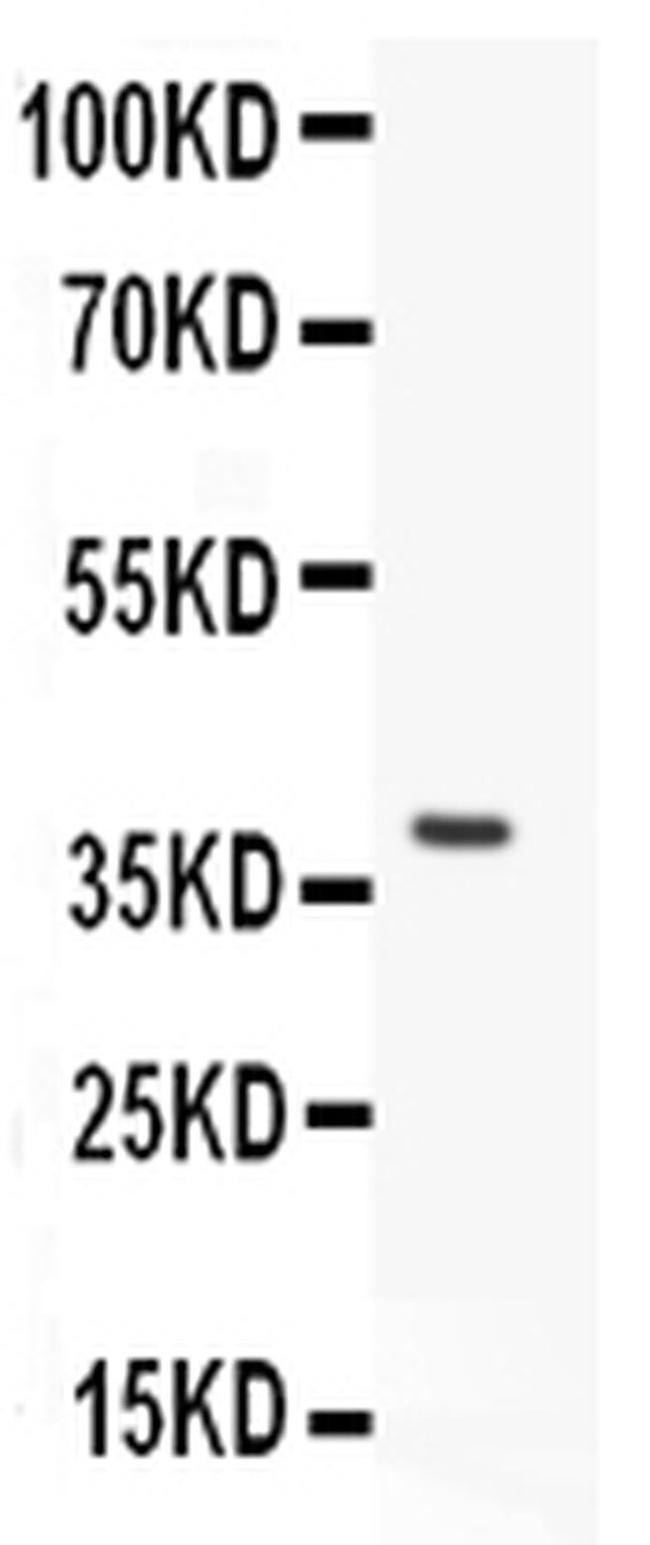 TRPC7 Antibody in Western Blot (WB)