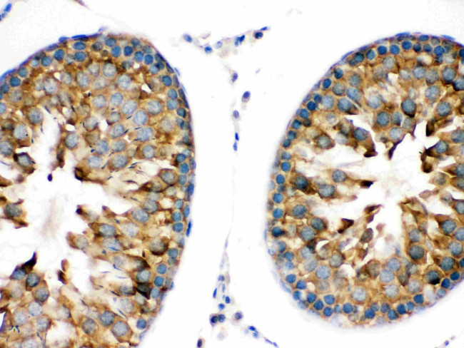 TRPM5 Antibody in Immunohistochemistry (Paraffin) (IHC (P))