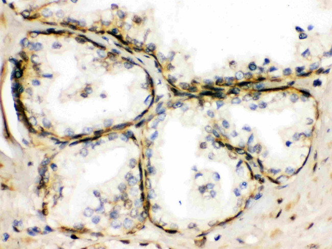 TRPM5 Antibody in Immunohistochemistry (Paraffin) (IHC (P))