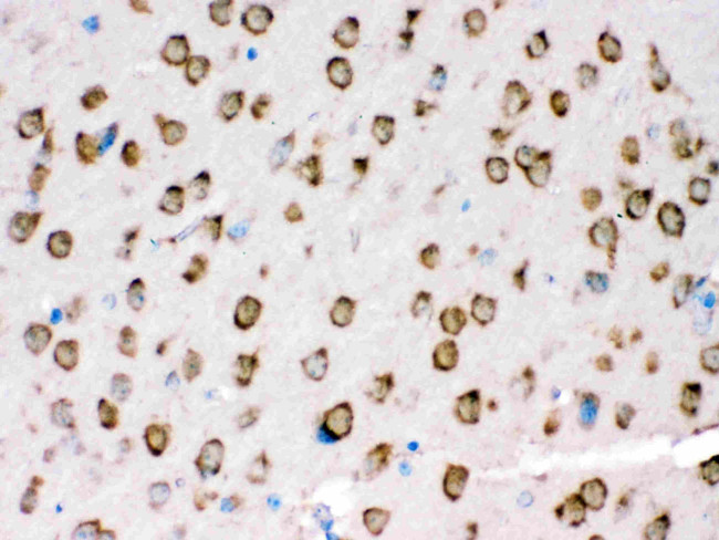 TRPM5 Antibody in Immunohistochemistry (Paraffin) (IHC (P))