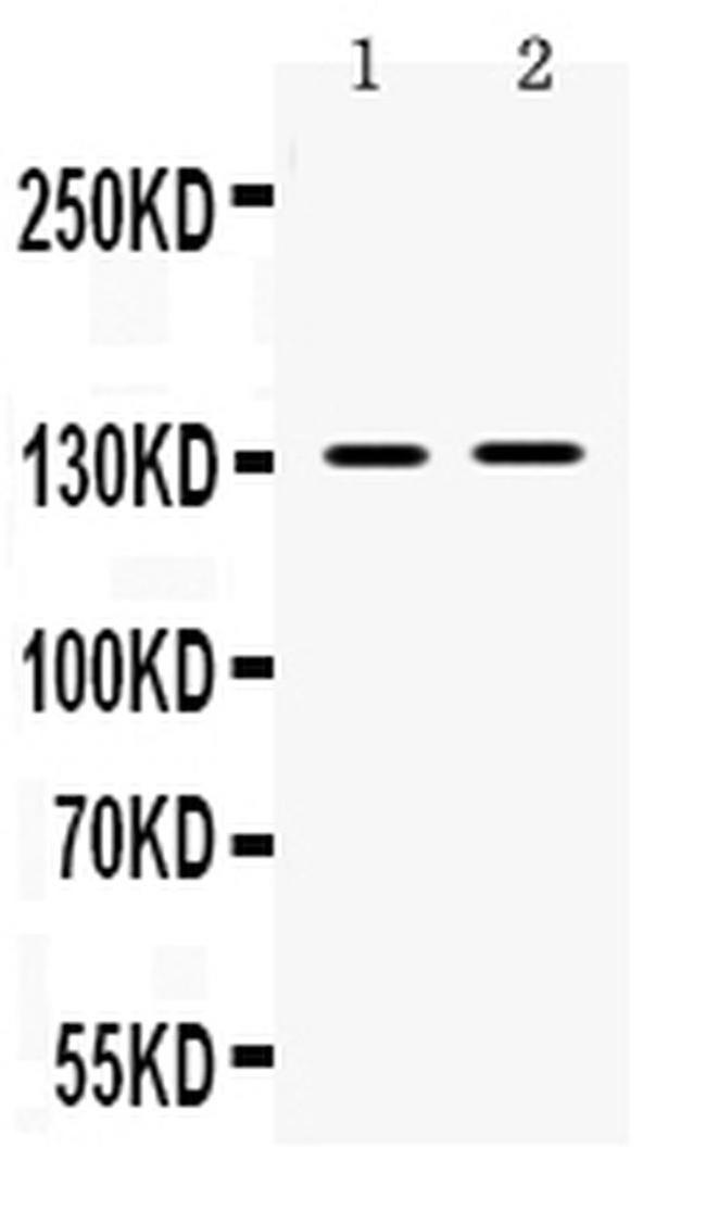 TRPM5 Antibody in Western Blot (WB)