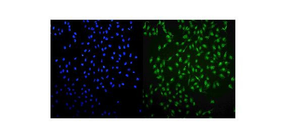 UHRF1 Antibody in Immunocytochemistry (ICC/IF)