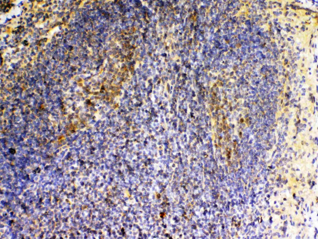 VEGFB Antibody in Immunohistochemistry (Paraffin) (IHC (P))