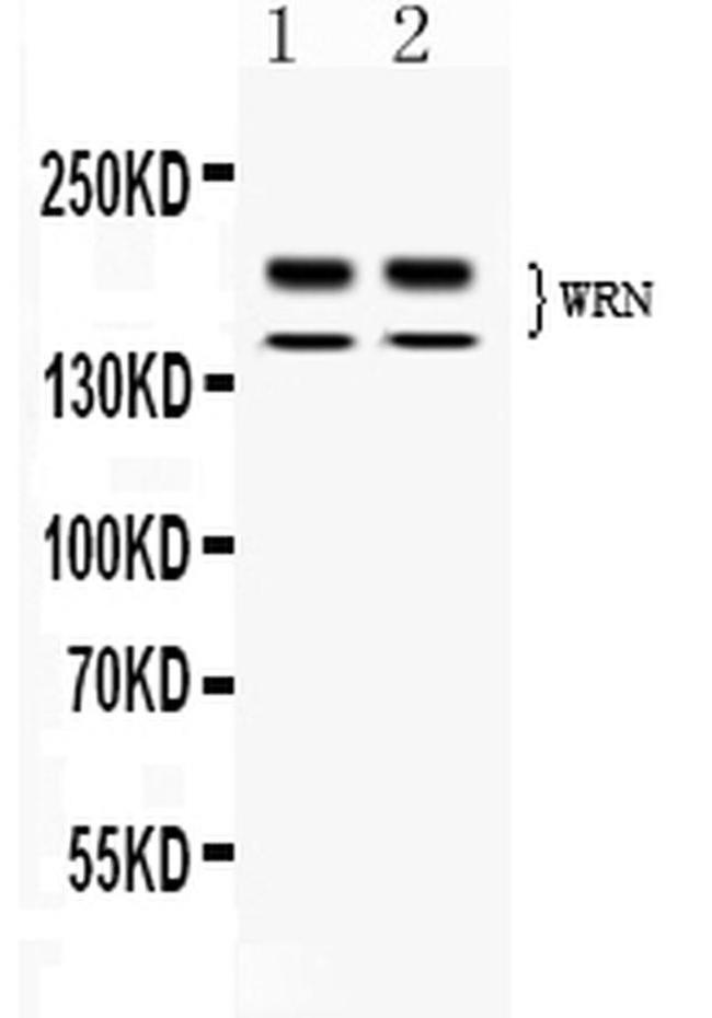 WRN Antibody in Western Blot (WB)