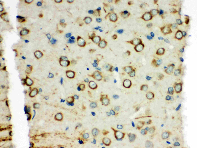 XRCC3 Antibody in Immunohistochemistry (Paraffin) (IHC (P))