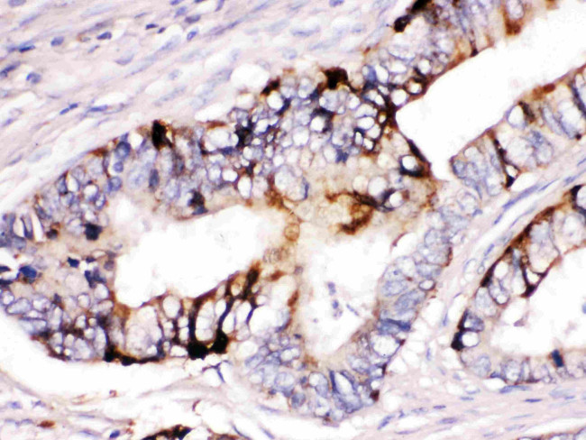 ZP2 Antibody in Immunohistochemistry (Paraffin) (IHC (P))