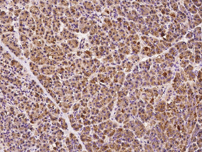 ABCD1 Antibody in Immunohistochemistry (Paraffin) (IHC (P))