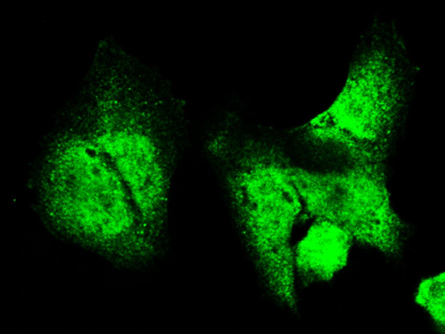 Acid Phosphatase 1 Antibody in Immunocytochemistry (ICC/IF)