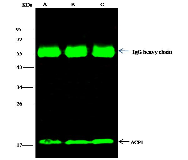 Acid Phosphatase 1 Antibody in Immunoprecipitation (IP)